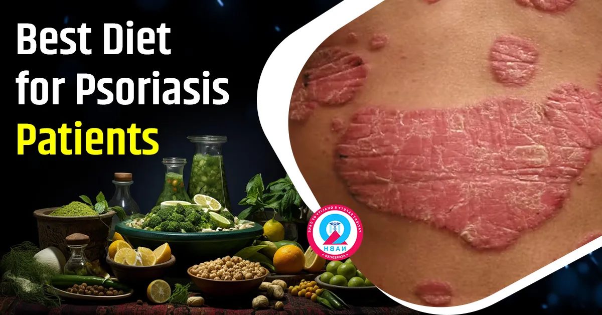 best-diet-for-psoriasis-patients